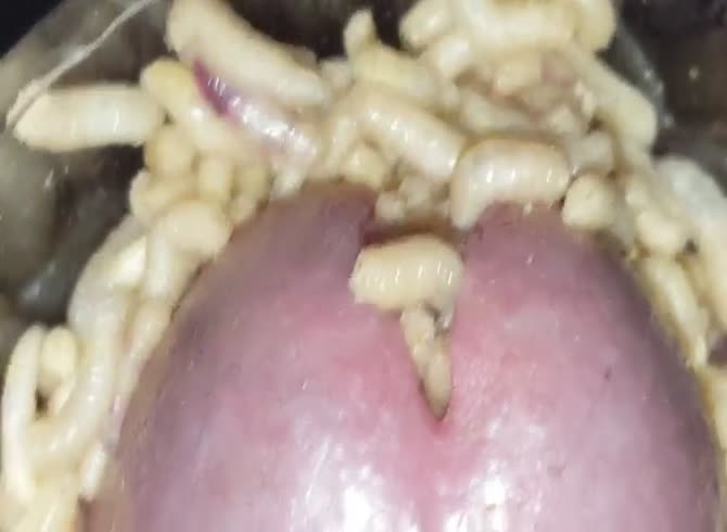 Video :Worms going inside a nasty dude's dick